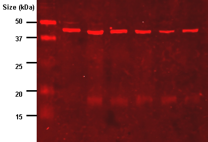 Photograph of a Western blot